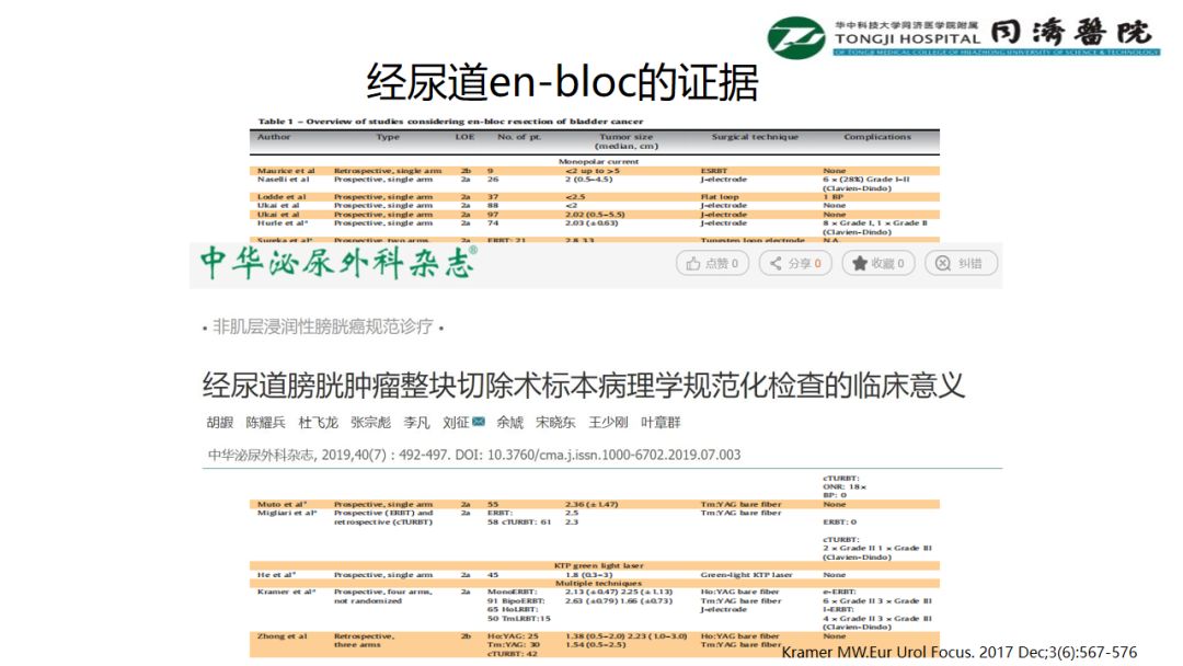 铥激光手术视频大赛-经尿道en-bloc的证据