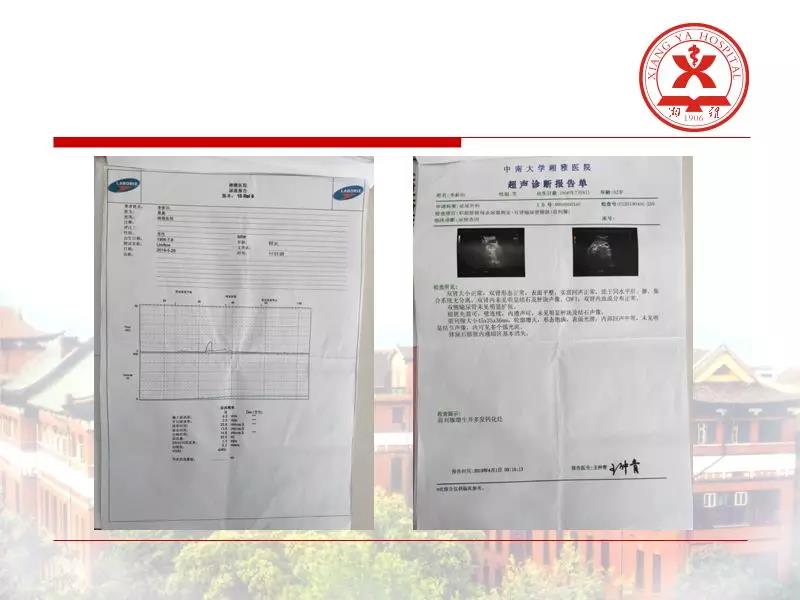 瑞柯恩培训学院第5期,经尿道前列腺激光切除术-张晓波