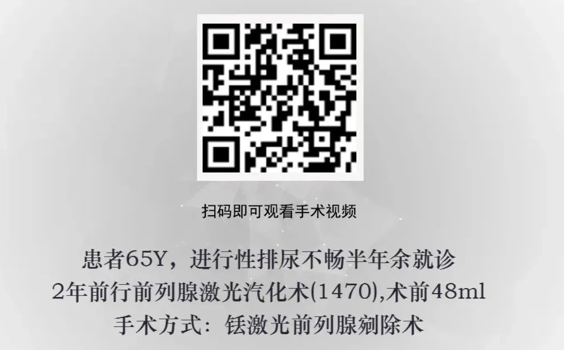 铥激光，初学者的自由之光,瑞柯恩