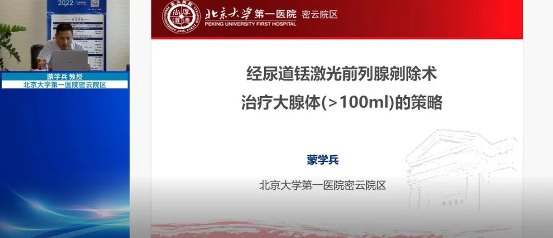 北京大学第一医院密云院区 蒙学兵教授 分享“经尿道铥激光前列腺剜除术治疗大腺体（≥100ml）的策略”,泌尿行,泌尿外科医疗设备,瑞柯恩
