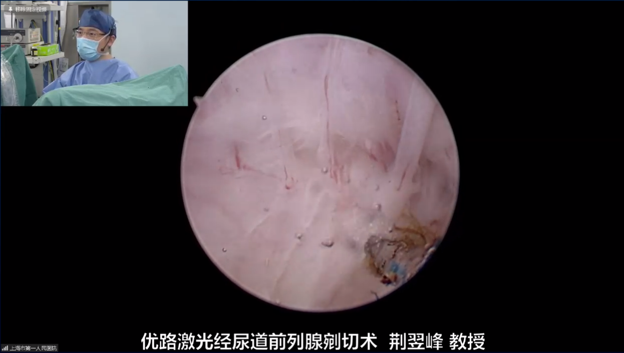 上海交通大学医学院附属第一人民医院-荆翌峰教授，优路激光经尿道前列腺剜切术,铥激光,医用铥激光,瑞柯恩